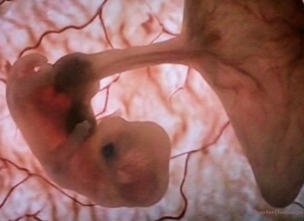 embryo-30-dagen